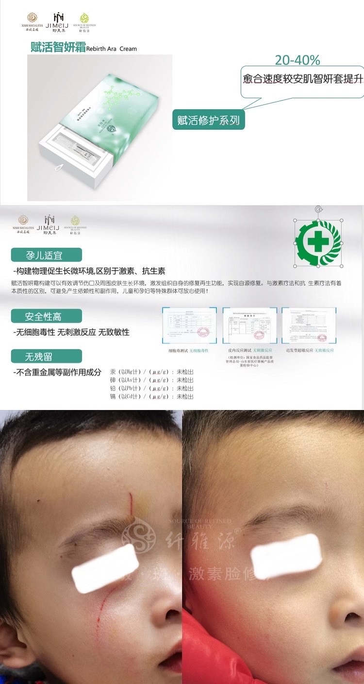 新年新品丨王牌技術(shù)再升級(jí)，祛斑更簡(jiǎn)單了。